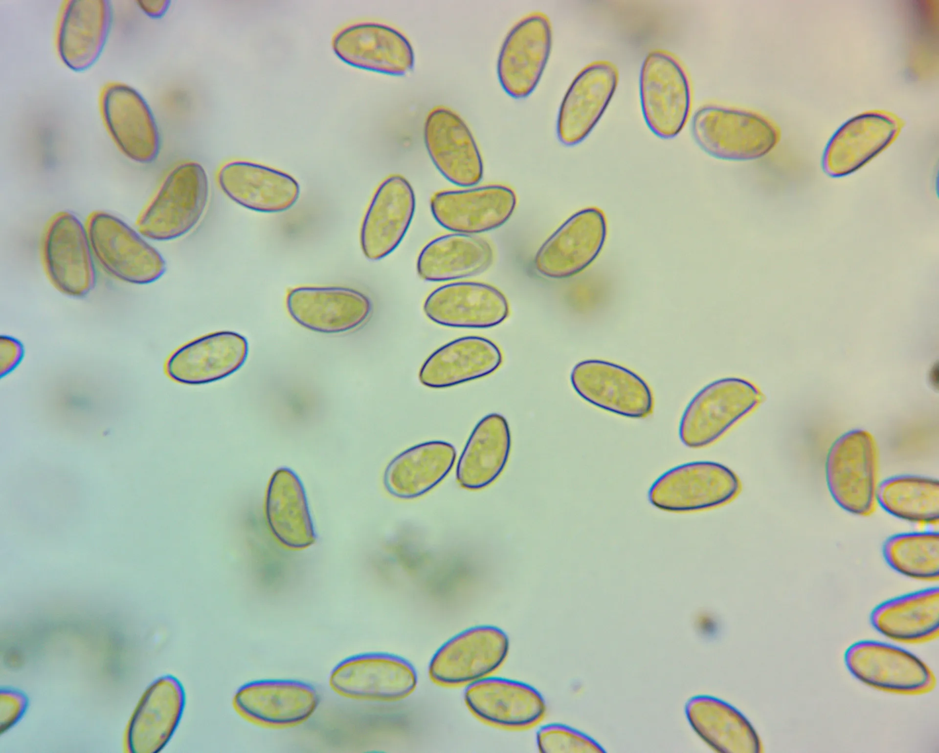 Microscopía de Inocybe pseudodestricta - esporas (1)